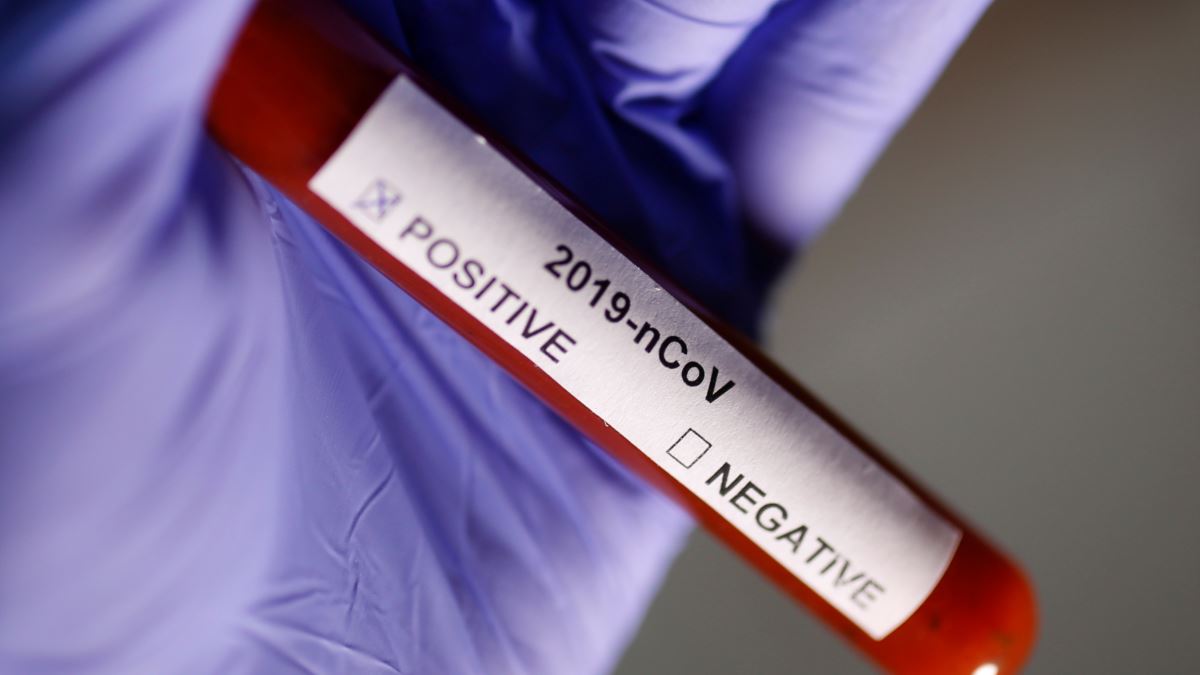 0162ADDD-7DDF-46DF-93A2-A0818C974018_cx0_cy3_cw0_w1200_r1